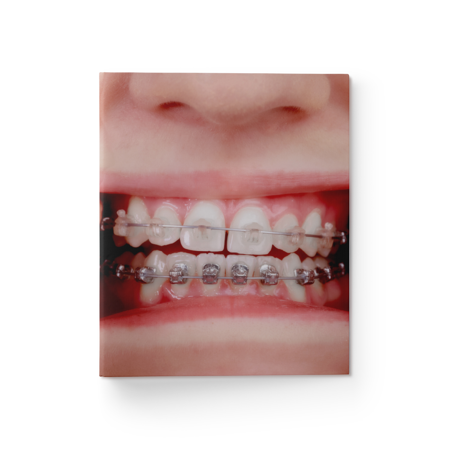 carousel-882780